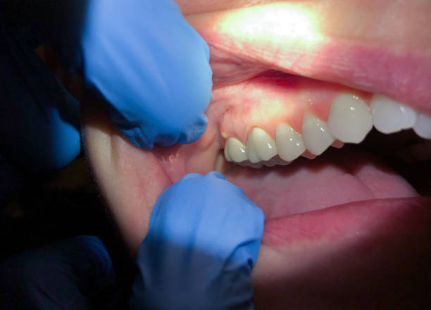 Best Emergency Treatment for Toothache in Moravian Falls, NC